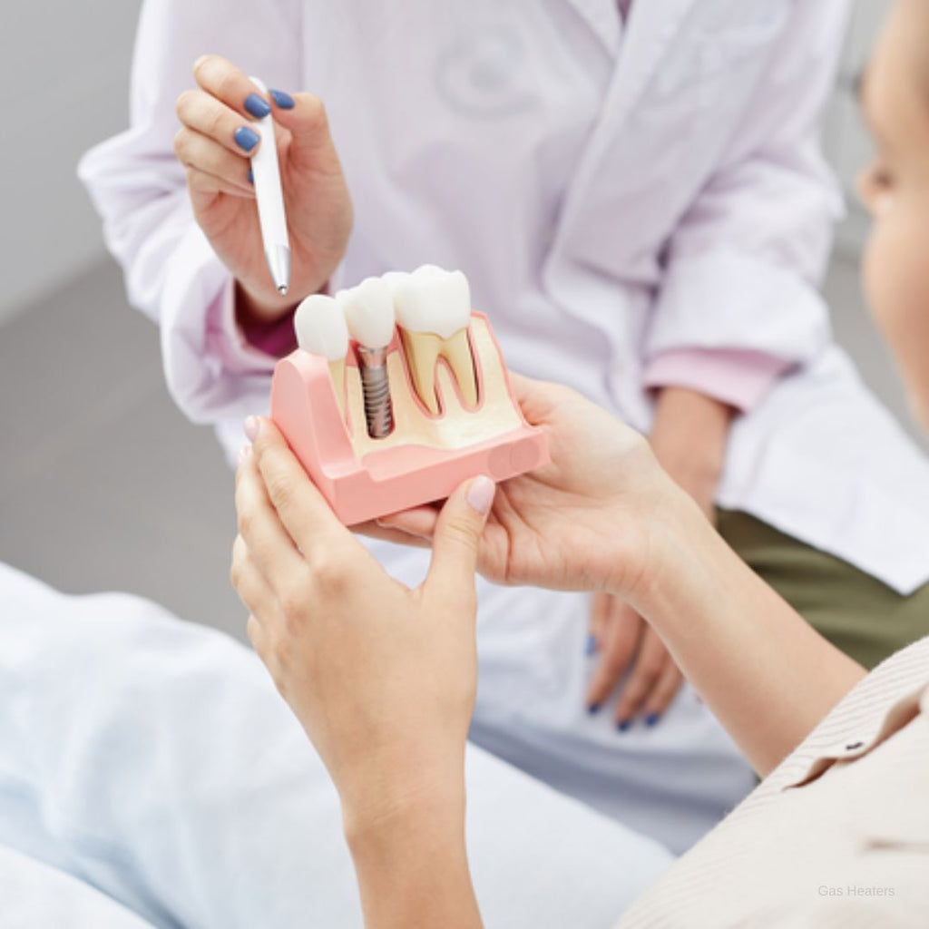 Dental Implants