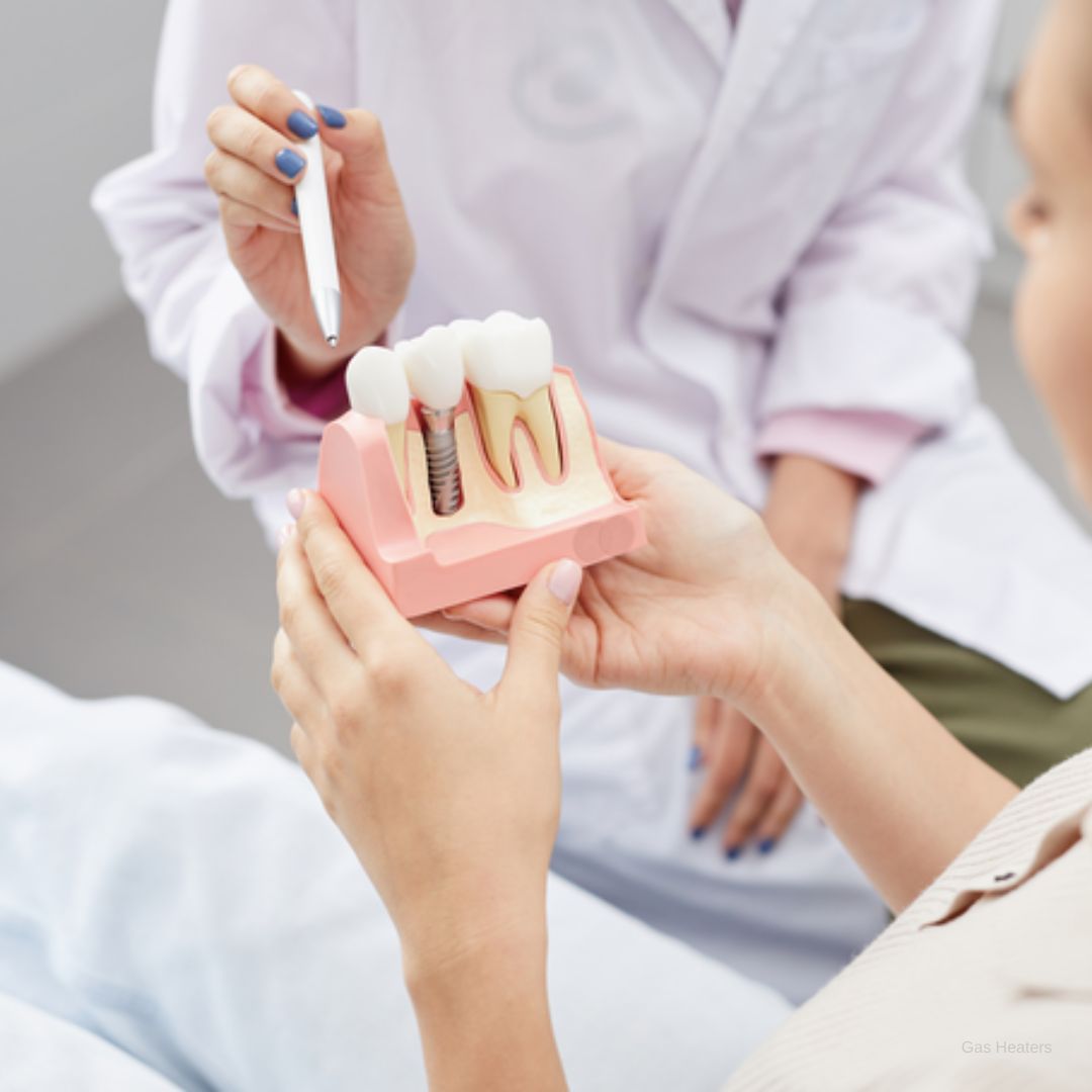 Dental Implants