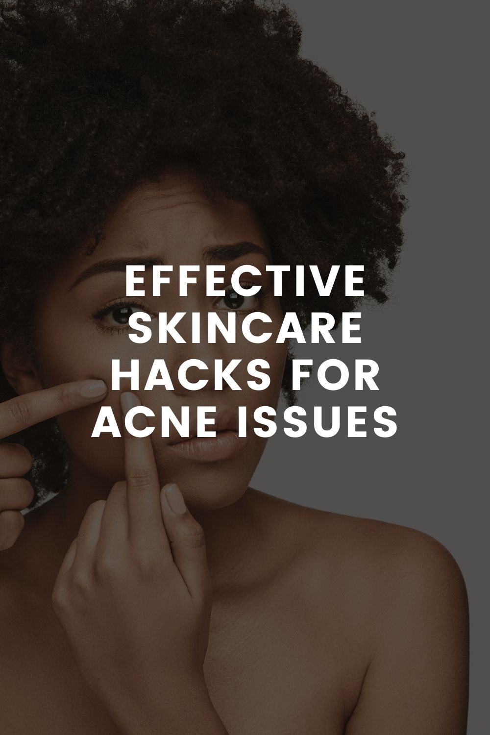 Effective Skincare Hacks For Acne Issues