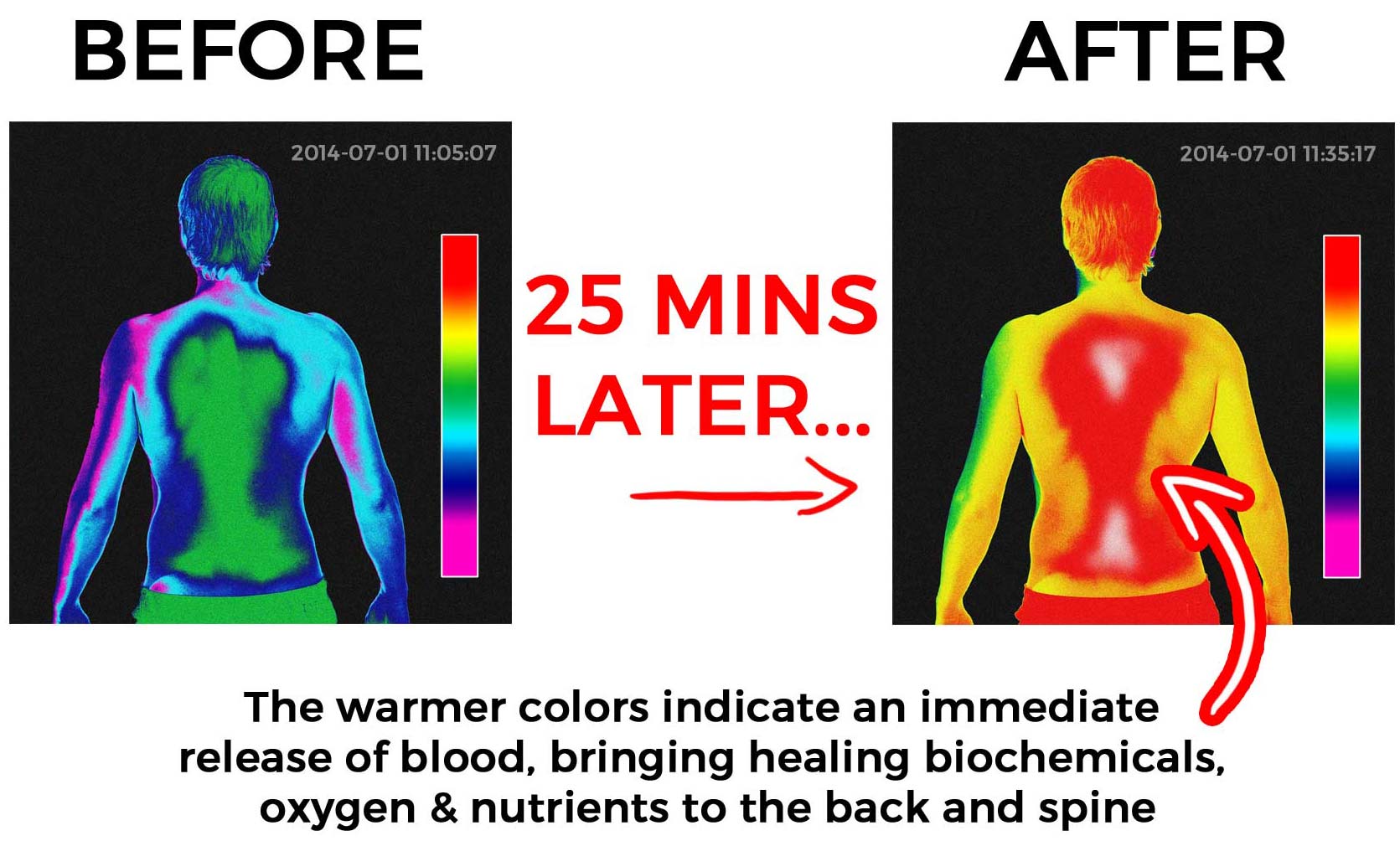 back pain relief