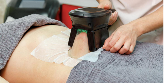CoolSculpting